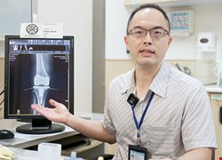 人工關節染蜂窩性組織炎 八旬翁走路痛如刀割 光吃抗生素無效 植入「3D列印活動型骨水泥」  術後隔天即可使用輔具下床行走 成功阻斷細菌感染