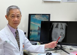 先天迴腸閉鎖、腸扭轉與嚴重穿孔 小寶貝生命垂危 中醫大附醫及兒醫跨科醫療團隊與時間賽跑 出生第二天精準手術搶救 順利康復出院